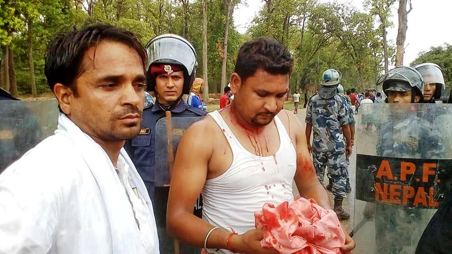 मन्त्री बिना मगरलाई काङ्ग्रेस कार्यकर्ताले कालो झण्डा देखाउने क्रममा झडप | OmkarTimes.com