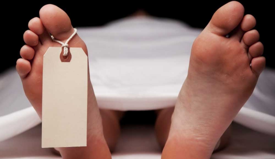 पित्तथैलीको अप्रेसन गर्दा आन्द्रा छेडियोपछि  बिरामीको मृत्यु