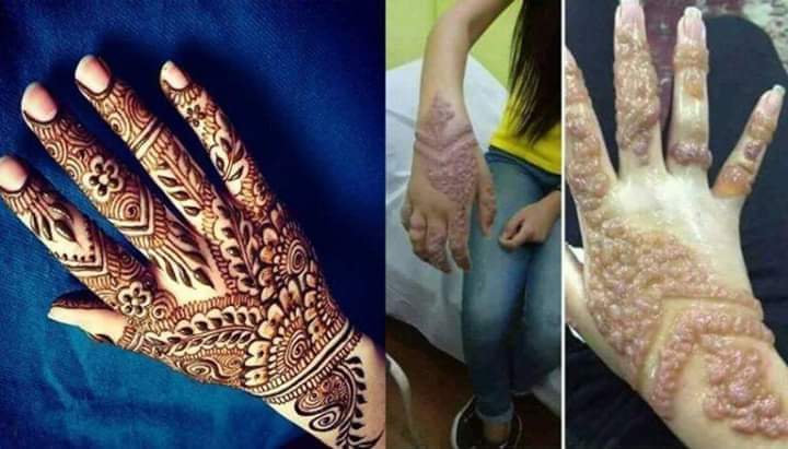 मेहन्दी लगाउँदा यस्तो गल्ती नगर्नुहोस, क्यान्सरसम्म हुन सक्छ | OmkarTimes.com