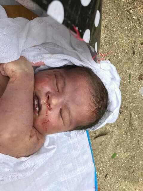 बच्चाको मृत्यु , आमाको पाठेघर फुट्यो,अस्पताललाई लापरबाहीको आरोप