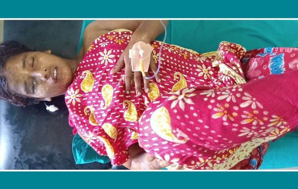 जनकपुरमा एक युवतीमाथि एसिड प्रहार