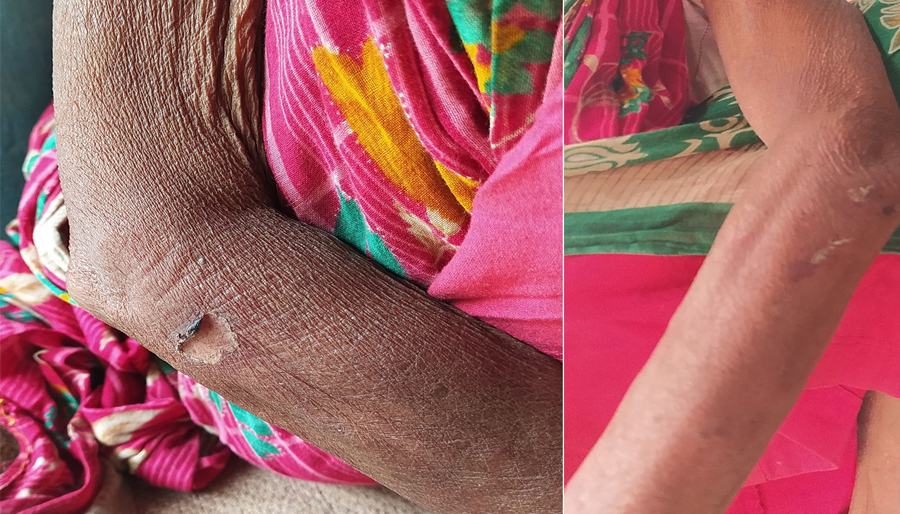 मोरङमा बोक्सीको आरोपमा ६० वर्षीया वृद्धालाई बाँधेर कुटपिट