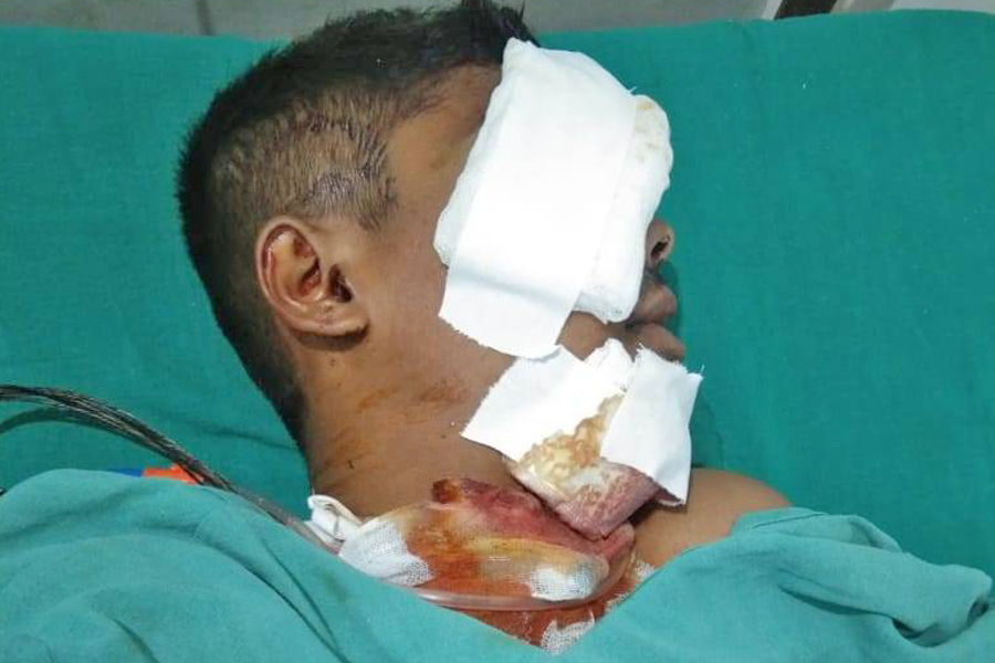आफैले बोकेको राइफल पड्किँदा सेनाका जवान गम्भीर घाइते