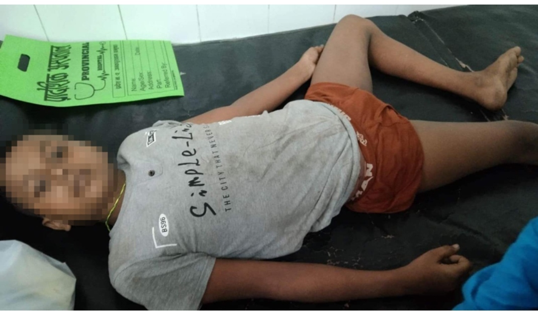 लिफ्टमा खेल्न आएको भन्दै होटल संचालकले १३ वर्षे बालकलाई गरे निर्घात कुटपिट