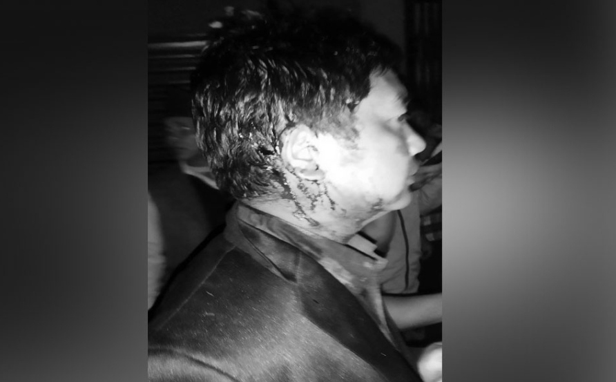 माओवादी कार्यकर्ताले अध्यक्षका उम्मेदारमाथि आक्रमण गरेपछि कांग्रेसले रोक्यो मतगणना
