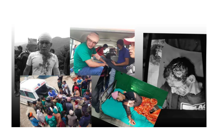 रुकुममा माओवादीका कार्यकर्ताद्वारा कांग्रेसका कार्यकर्तामाथि निर्घात कुटपिट